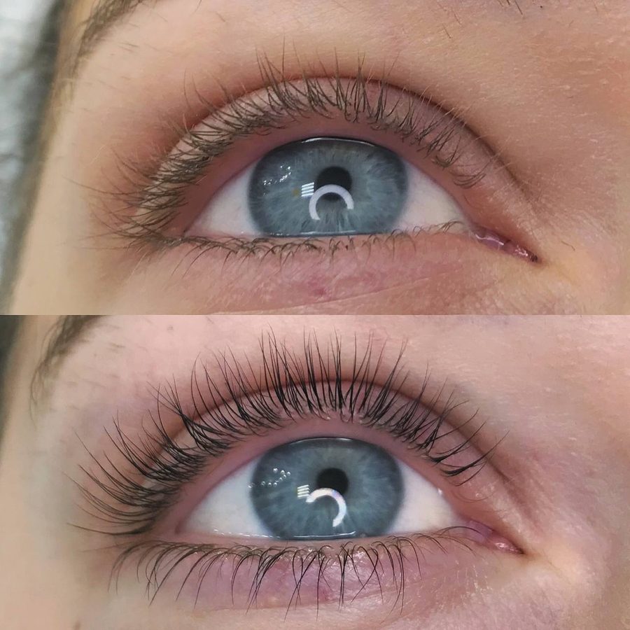 InLei® Lash Filler Lift — before & after (set 3)